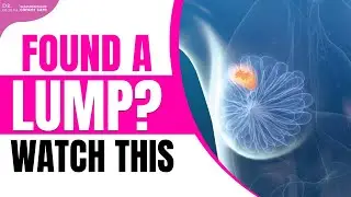 Found a Lump? Watch this | SloanMacCallum Cancer Care