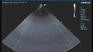 MANDOCDOC, TEOTIMO 02