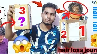 3ed hair treatment for unboxing 💊 🩺 box for daily use regrowth hair stop hair loss 😵 #adon #waidon 