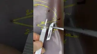 Rotation Flap Surgery 😷📐 #goodtoknow #surgeonlife #vet #medicine #geometry  #surgery #funfacts