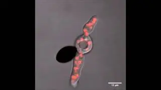 Nuclear dynamics in the homothallic ascomycete Sordaria fimicola