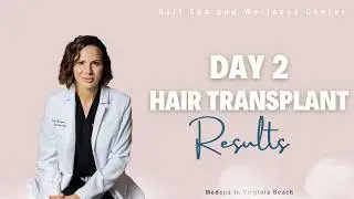 Most Advanced Virginia Beach Hair Transplant | Salt Spa & Wellness Center