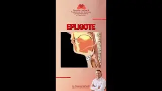 EPIGLOTE