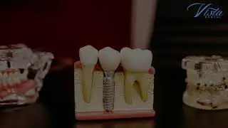 September is Dental Implant Awareness Month I VISTA DENTAL