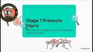 Pressure Injuries Explained: Causes, Stages, and Why Early Nursing Assessment Matters