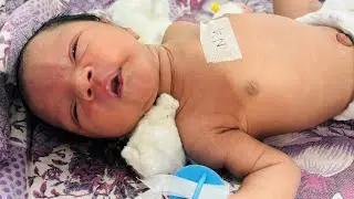 New Born Baby FirstSucking in NICU #NewBornBaby #BabyInNICU #FirstFeeding #FirstSucking #NICUCare