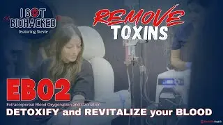 EBO2 (Extracorporeal Blood Oxygenation and Ozonation) filters and removes toxins from blood.