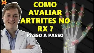 RADIOLOGIA APLICADA À REUMATOLOGIA | Sessão conjunta VR e LIRES