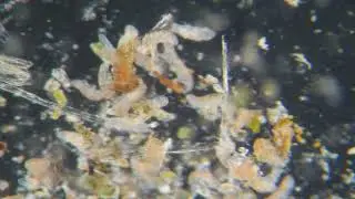 Neue B&auml;rtierchen-Art im Schwarzwald entdeckt - New species of tardigrade discovered!