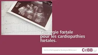 Chirurgie : Comment traiter les cardiopathies foetales ?