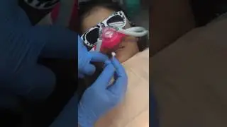 Topical Anesthesia Dr. Ali B. Attaie - Pediatric Dentistry Techniques