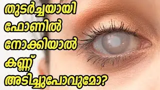 കണ്ണ് അടിച്ചുപോവുമോ? Smartphone increase risk of blindness
