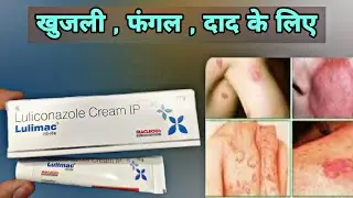 luliconazole cream | lulimac cream | Antifungal Cream | luliconazole medicine | infection