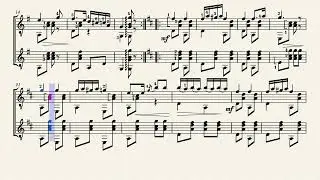 Wide Awake Polka &ndash; Robert Walter Jacobs (1868 - 1945)