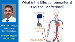 What is the Effect of venoarterial ECMO on LV afterload?