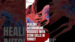 New Hope for Romanians: Stem Cell Treatment in Turkey for Autoimmune Diseases