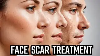 Face Scar Treatment: Full Ablative vs Fractional CO2 Laser | Nose Reshaping Combo