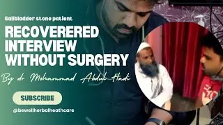 Gallbladder Stone Patient Recovered interview without Surgery   by Dr mohd Abdul Hadi