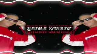 Man, I Need Mashup (RaxzTunez) NoxXare Remix 2K25