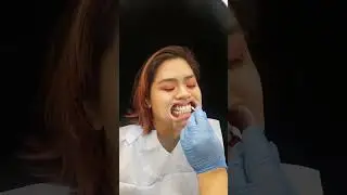 Teeth Whitening at Mint Smilebar is QUICK, EASY, PAINLESS