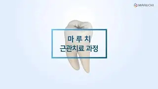 마루치 최소침습 근관치료 가이드