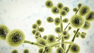 Candida Glabrata In gynecology; yeast species, role in vulvovaginal candidiasis