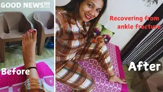 Ankle Fracture|Leg Cast|Plaster|Ankle fracture recovery|SelfMotivation|Precaution after cast removal