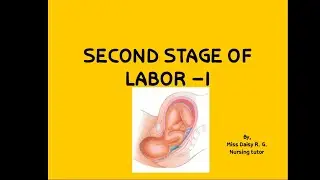 Second stage of labor notes