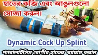 স্টক প্যারালাইসিস রোগীদের হাতের আঙ্গুলের ব্যায়ামের জন্য dynamic cock up splint hand exercise