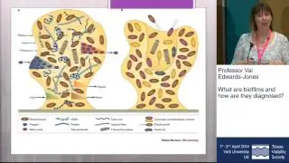 TVS 2014 - THE CONFERENCE - PROFESSOR VAL EDWARDS JONES