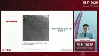 Room A- A5- Device selection in HFrEF patient with diffused coronary artery disease: DES or DCB?
