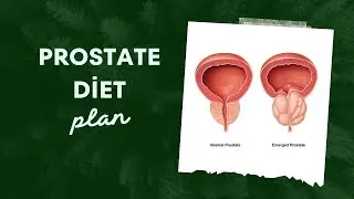 prostate healthy diet plan