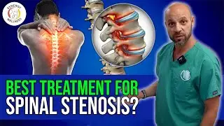 What's the BEST Treatment for Stenosis? Spinal Surgery | Physical Therapy | Chiropractic