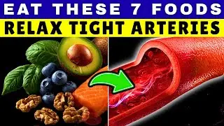 Top 7 Foods That Unclog Arteries & smooth Circulation