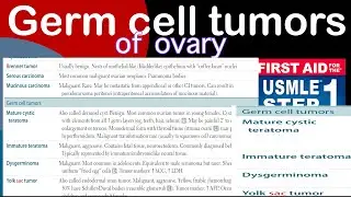 Germ cell tumors of ovary in Hindi/Urdu by first aid for USMLE step 1