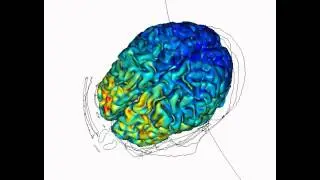 Cortical Modulation using tDCS - High-Resolution Computational Model of tDCS