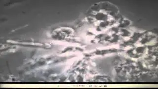 Phase contrast microscope viewing and recording bacteria in denta plaque at 1000x