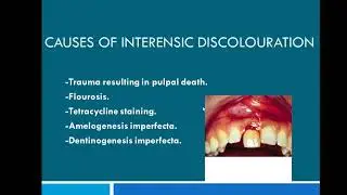 What are the methods used to improve interensic  tooth  discolouration?(mjdf)#toothdiscolouration