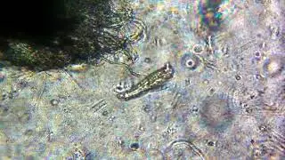Amazing Rotifer Locomotion |Wheel Animalcule|