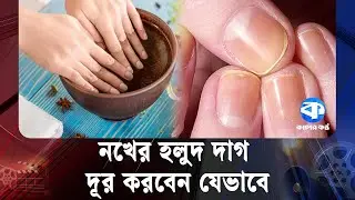 নখের হলুদ দাগ দূর করবেন যেভাবে | Nail Care | Yellow Stain Removal | Kaler Kantho Health