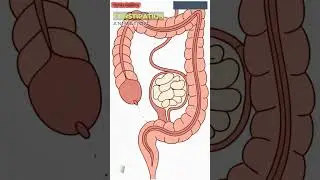 Constipation Blocking the Colon Lumen | Human Anatomy | Digestive System | Gut AI Art | 17