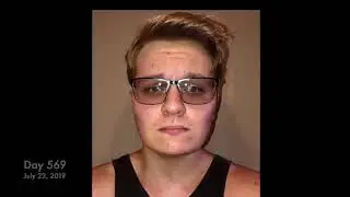 Alexander Takes a Selfie Every Day for 3 Years