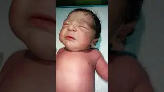 so cute baby 🥰 #medical #newbornbaby #trending #baby #cute #newborn #motivation #nursing #hospital