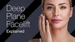 Deep plane facelift explained