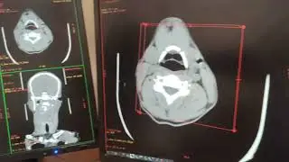 NCCT FACE FILMING BY SHIVANKUR SHARMA