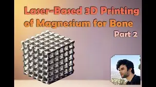 How Do Patient-Specific Magnesium Implants Enhance Bone Regeneration?  | Review Article