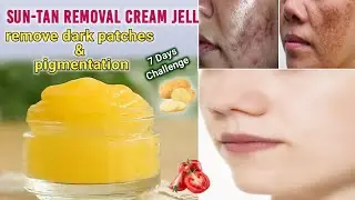 7 days sun-tan removal challenge | remove DARK SPOTS, ACNE SCARS, PIMPLE MARKS, PIGMENTATION 100%