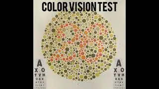 Test Your Eyes | Colour Blindness Test #eyetest #ytshort #guesswhat