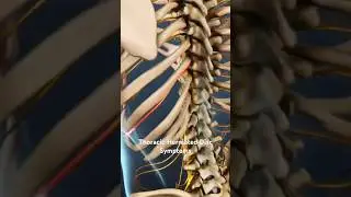 Thoracic Herniated Disc Symptoms