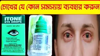 ITONE EYE DROPS Review In Bangla | চোখের যে কোন সমস্যায় ব্যবহার করুন | Best Eye Drop